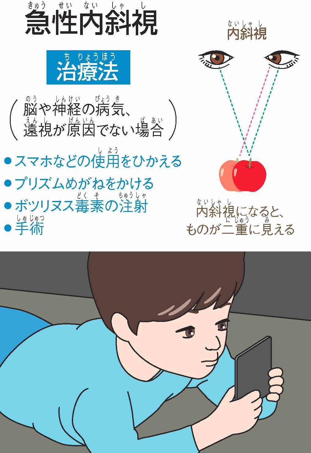 斜視 原因 スマホ