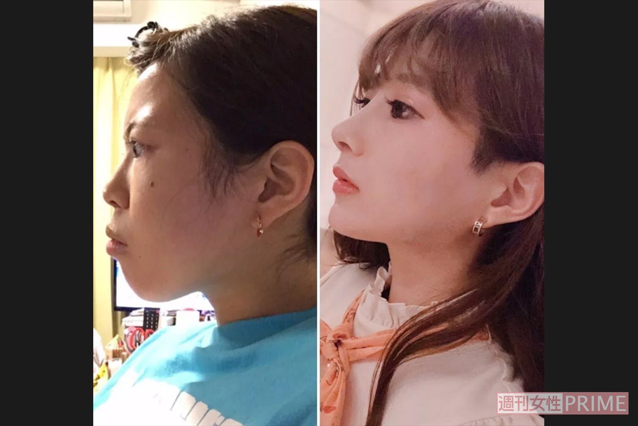 整形 av 女優