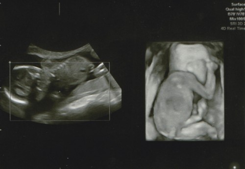 ◆オーダー用◆ ダイカット 妊婦さん エコー写真 baby ◇オーダー用◇ ダイカット 妊婦さん エコー写真 baby